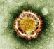 Nouveau coronavirus : état toujours stationnaire et sérieux pour les deux malades français