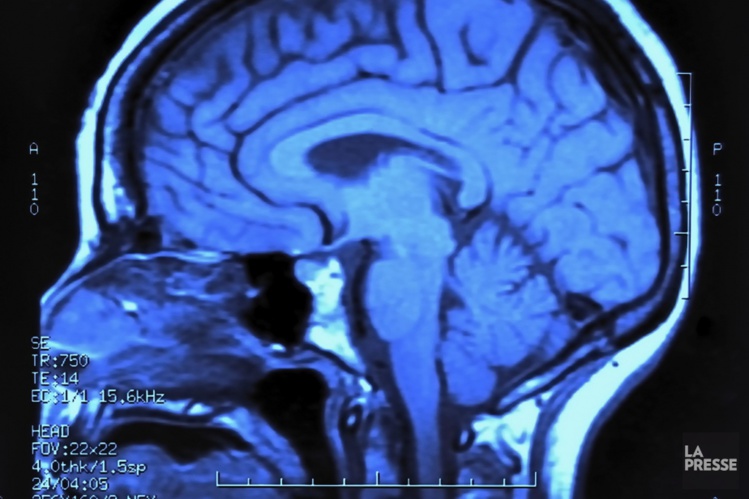 Des recherches sur la connexion entre l'oeil et le cerveau primées à Lisbonne Des recherches sur la connexion entre l'oeil et le cerveau primées à Lisbonne