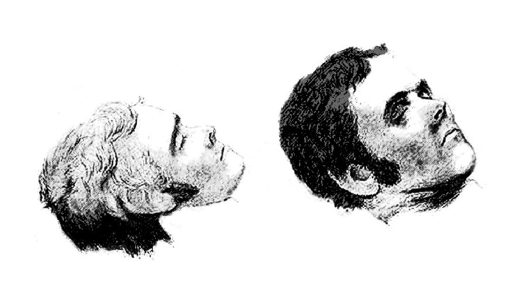 Avant de passer sur la table de dissection, un portrait post mortem de Pearce a été exécuté. Avant de passer sur la table de dissection, un portrait post mortem de Pearce a été exécuté.