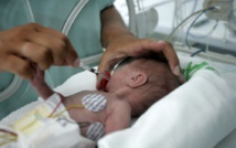 Un nourrisson décède après avoir reçu une dose de vitamine D (ANSM) Un nourrisson décède après avoir reçu une dose de vitamine D (ANSM)