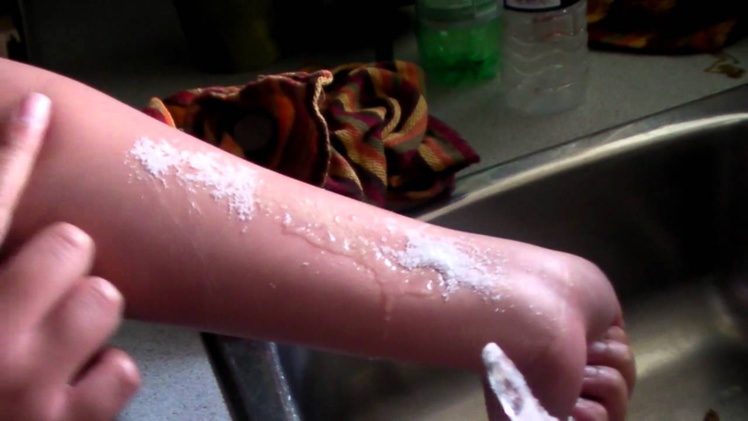 Page enfant : Ice and salt challenge, attention danger ! Page enfant : Ice and salt challenge, attention danger !