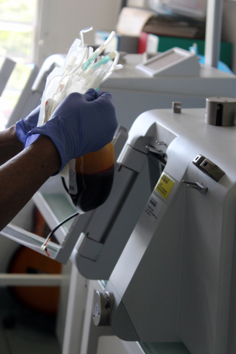 la force centrifuge de la machine sépare le plasma des plaquettes et des globules rouges. Une machine sépare les trois parties du sang dans des poches différentes. la force centrifuge de la machine sépare le plasma des plaquettes et des globules rouges. Une machine sépare les trois parties du sang dans des poches différentes.