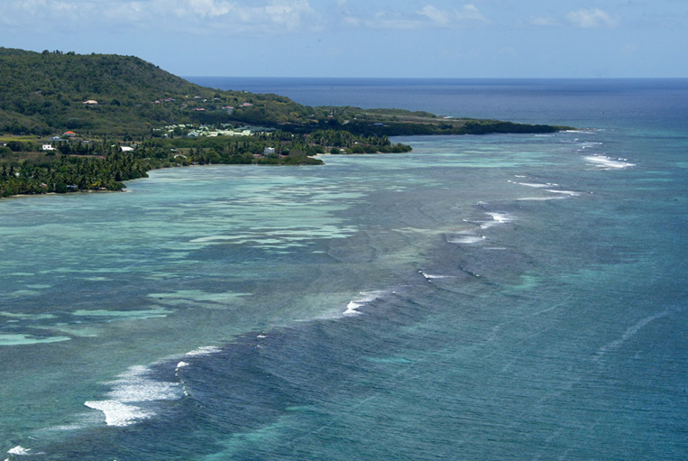 Guadeloupe : un collégien de 11 ans blessé par balles