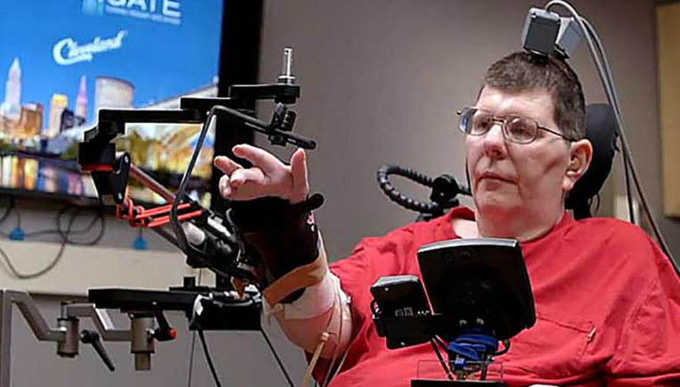 Totalement paralysé, il réussit à se servir de son bras grâce à des implants cérébraux Totalement paralysé, il réussit à se servir de son bras grâce à des implants cérébraux