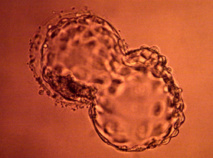 Dépakine: entre 2.000 et 4.000 cas de malformations majeures (Agence du médicament) Dépakine: entre 2.000 et 4.000 cas de malformations majeures (Agence du médicament)