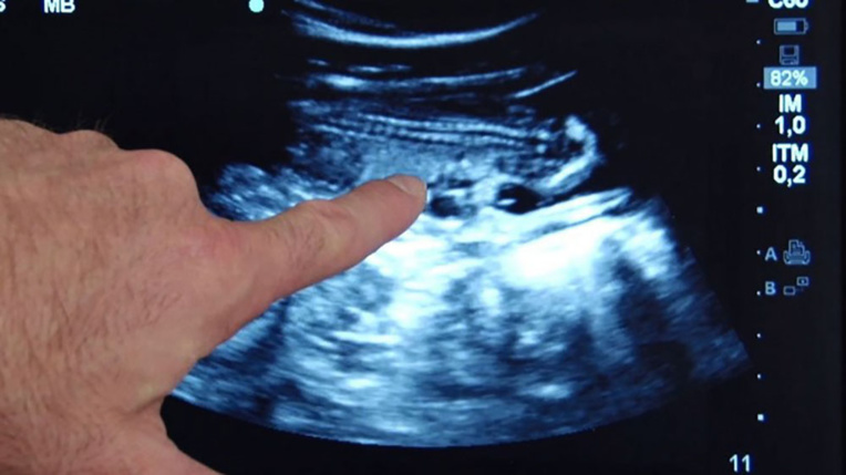 Le zoo de Beauval se prépare fébrilement à la naissance des premiers bébés pandas de France Le zoo de Beauval se prépare fébrilement à la naissance des premiers bébés pandas de France