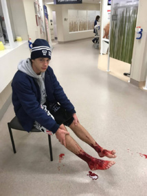 Un jeune Australien ressort d'une baignade nocturne les pieds ensanglantés Un jeune Australien ressort d'une baignade nocturne les pieds ensanglantés