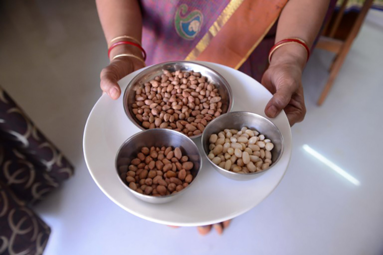 Allergie à l'arachide: des chercheurs australiens annoncent une avancée majeure Allergie à l'arachide: des chercheurs australiens annoncent une avancée majeure