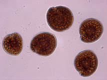 La micro-algue Gambierdiscus toxicus qui cause la ciguatera