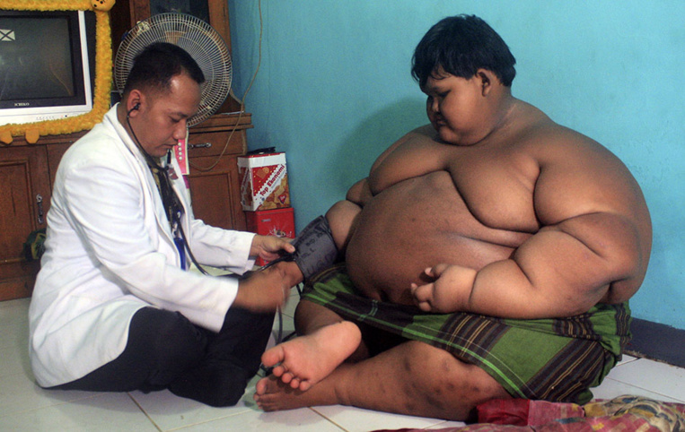 Dix fois plus d'enfants et d'ados obèses qu'il y a 40 ans