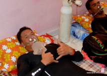 Séance de masque à oxygène pour éliminer le monoxyde de carbone du sang. Séance de masque à oxygène pour éliminer le monoxyde de carbone du sang.