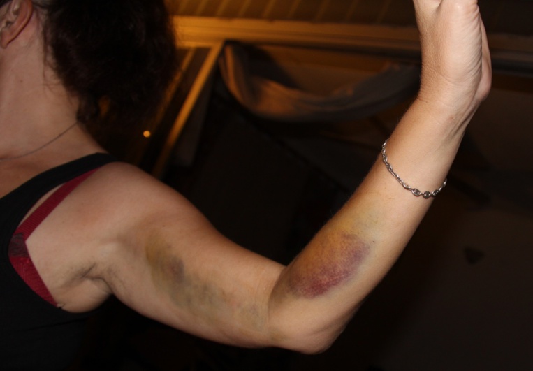 Violences faites aux femmes : les violences sexuelles en forte augmentation Violences faites aux femmes : les violences sexuelles en forte augmentation