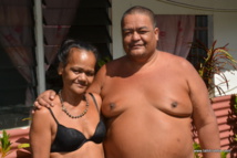 Cécile, ancienne malade de la lèpre : "Mes parents m'ont mise de côté" Cécile, ancienne malade de la lèpre : "Mes parents m'ont mise de côté"