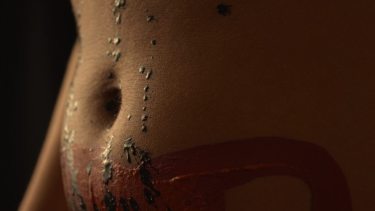 Endométriose : en parler pour soulager Endométriose : en parler pour soulager