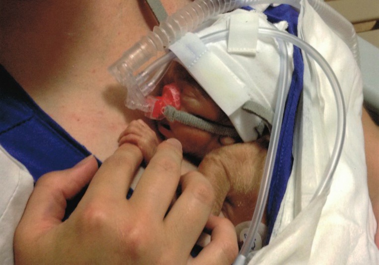 Un test sanguin peut prédire une naissance prématurée, selon une étude Un test sanguin peut prédire une naissance prématurée, selon une étude