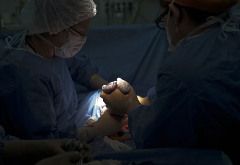 Mise en garde des gynécologues contre une "épidémie de césariennes"