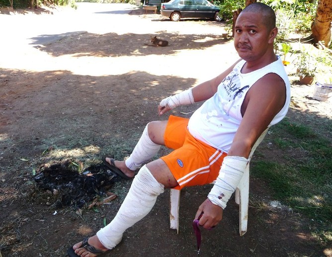 Attaque de chiens à Faa’a : « J’ai cru que c’était ma dernière heure »