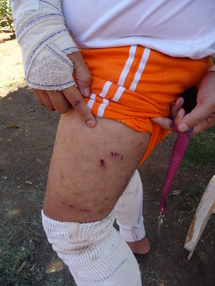 Attaque de chiens à Faa’a : « J’ai cru que c’était ma dernière heure »