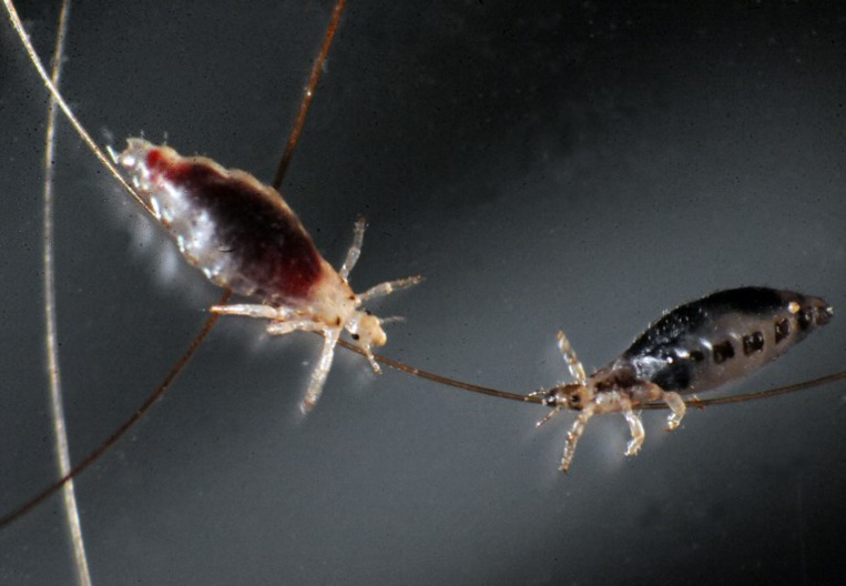 Arrêt de commercialisation de la lotion anti-poux Prioderm Arrêt de commercialisation de la lotion anti-poux Prioderm