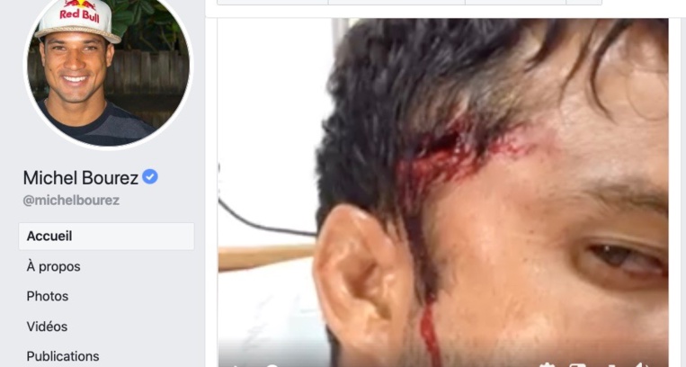 Surf libre – Michel Bourez se blesse à Teahupo’o Surf libre – Michel Bourez se blesse à Teahupo’o