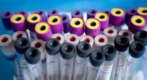 Un test sanguin sur biopuce pourrait révolutionner le dépistage des maladies
