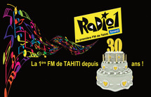 La FM 100 (Radio1) fête son 30ème anniversaire