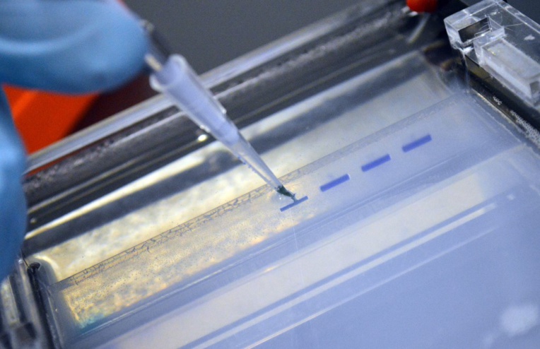 Un séropositif sous traitement efficace ne transmet pas le VIH, selon une étude Un séropositif sous traitement efficace ne transmet pas le VIH, selon une étude