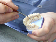Soins dentaires: bientôt plus de transparence sur l'origine des prothèses