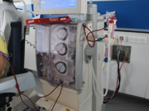 La dialyse permet de filtrer le sang des personnes dont les reins ne fonctionnent plus correctement. La dialyse permet de filtrer le sang des personnes dont les reins ne fonctionnent plus correctement.