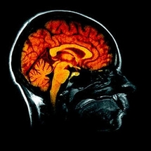 Exploration du cerveau: lire des images aujourd'hui, des pensées demain?