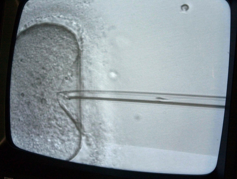 Un autre couple a porté leur enfant: une famille californienne attaque une clinique en justice Un autre couple a porté leur enfant: une famille californienne attaque une clinique en justice