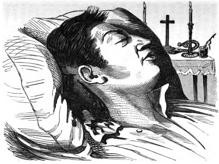 Gravure ancienne, forcément très approximative, de Mgr Epalle sur son lit de mort. Par décence, ses blessures ne sont pas montrées. Gravure ancienne, forcément très approximative, de Mgr Epalle sur son lit de mort. Par décence, ses blessures ne sont pas montrées.