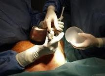 Prothèses PIP: environ 20% des porteuses se sont fait retirer leurs implants