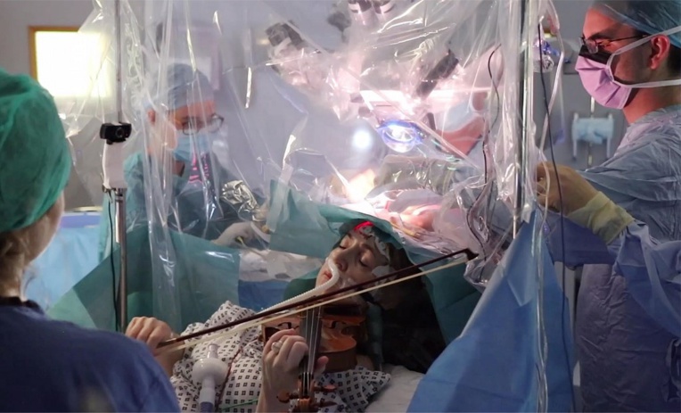Pour sauver sa main, une violoniste joue pendant son opération du cerveau Pour sauver sa main, une violoniste joue pendant son opération du cerveau