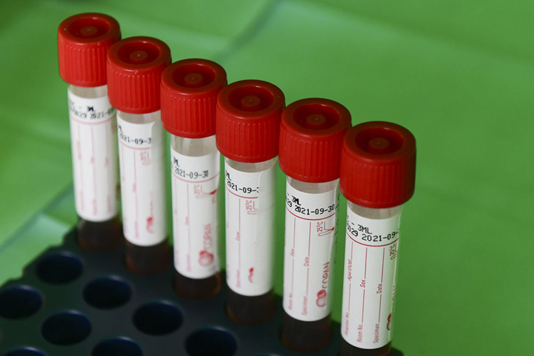 Martinique: la justice rejette une demande de dépistage systématique Martinique: la justice rejette une demande de dépistage systématique