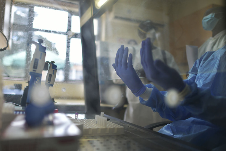 Coronavirus: le tocilizumab efficace pour les patients dans un état grave Coronavirus: le tocilizumab efficace pour les patients dans un état grave