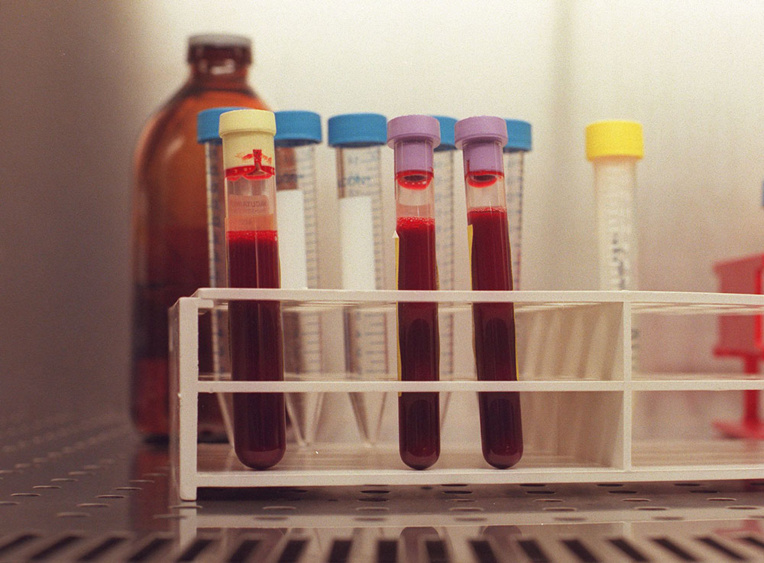 Covid-19: lancement d'un essai clinique avec un vieux médicament de psychiatrie