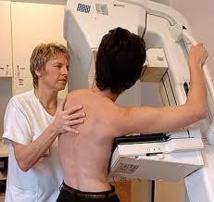 Cancer du sein : une organisation américaine accusée de trop vanter la mammographie