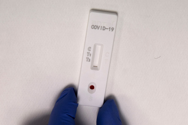 Coronavirus: moment de vérité pour les capacités de dépistage Coronavirus: moment de vérité pour les capacités de dépistage