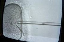 Des scientifiques créent des ovocytes viables à partir de cellules souches
