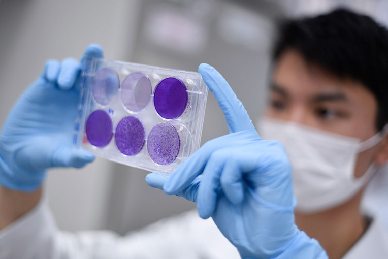 Covid-19: l'immunité pourrait disparaître en quelques mois, suggère une étude Covid-19: l'immunité pourrait disparaître en quelques mois, suggère une étude