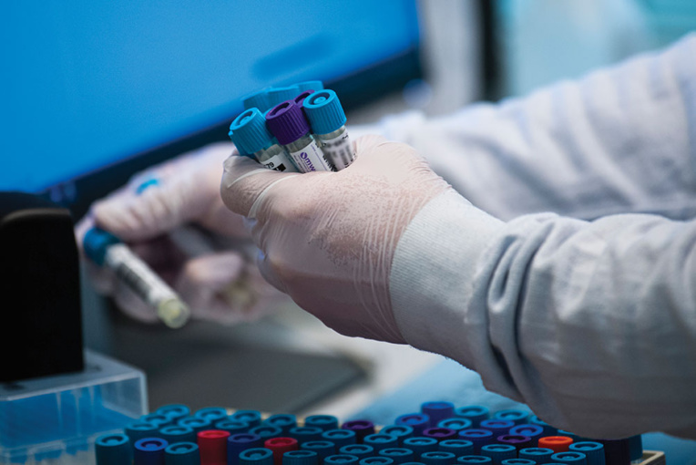 Virus: l'OMS déplore que dix pays concentrent 95% des vaccinations Virus: l'OMS déplore que dix pays concentrent 95% des vaccinations