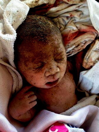 Îles Salomon : un nouveau-né déterré vivant