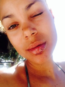 People: Tiga, l'animatrice de "Riding Zone" se blesse à Tahiti People: Tiga, l'animatrice de "Riding Zone" se blesse à Tahiti