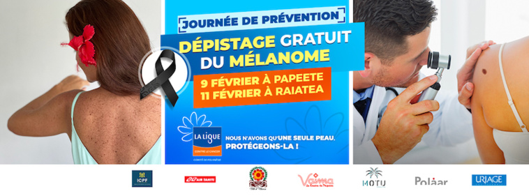 Dépistage gratuit du mélanome à Tahiti et Raiatea Dépistage gratuit du mélanome à Tahiti et Raiatea