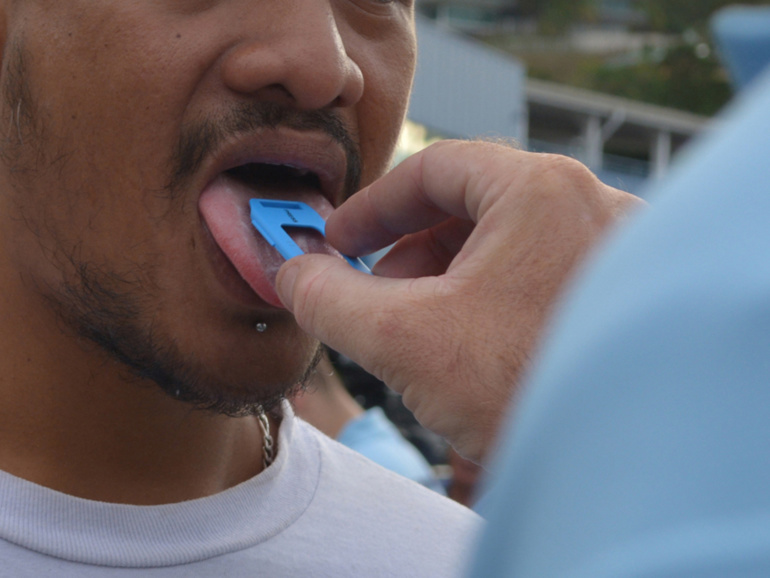 Pour pratiquer le test, il faut tirer la langue. Pour pratiquer le test, il faut tirer la langue.