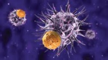 Leucémie aigüe: 88% des malades en rémission grâce à l'immuno-thérapie