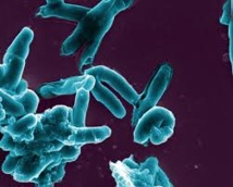 Un million d'enfants développent une tuberculose chaque année dans le monde Un million d'enfants développent une tuberculose chaque année dans le monde