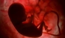 L'autisme résulterait d'anomalies dans la formation cérébrale du foetus