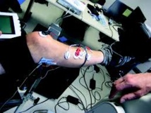 La stimulation électrique au secours de la paralysie